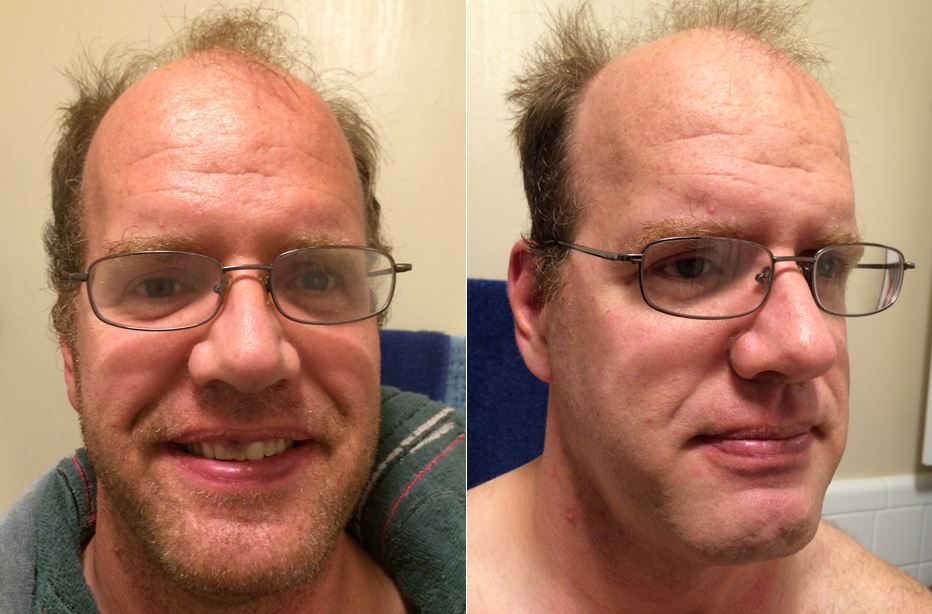 Dollar Shave Before and After  Image: Dakster Sullivan