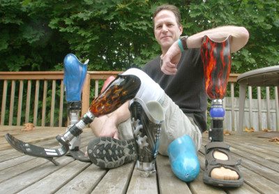 Dan Horkey with his collection of legs. Photo: Dan Horkey/ProstheticINK.com